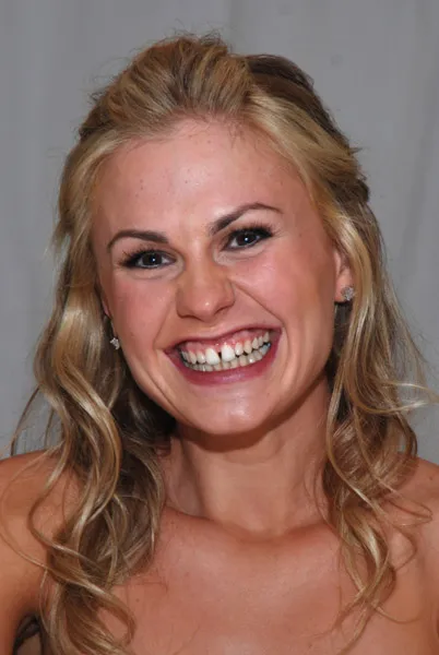 anna-paquin-big-teeth anna-paquin-big-teeth